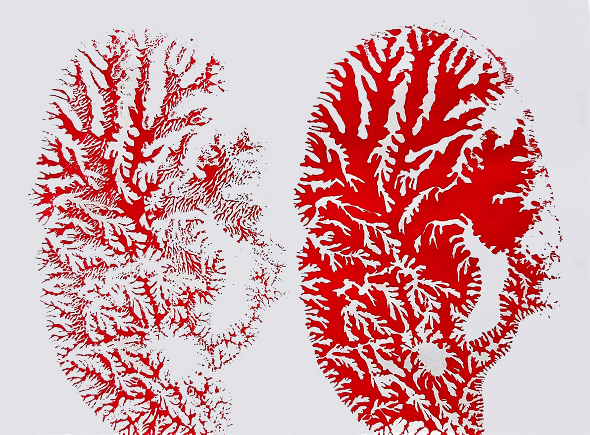 N.Machoń%20monotypia5 kopia